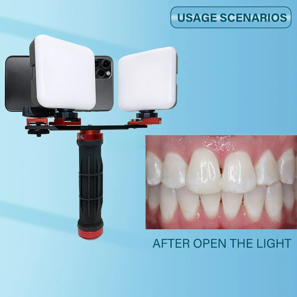 Lampe de photographie dentaire - Photography Lighting Accessories avis et prix
